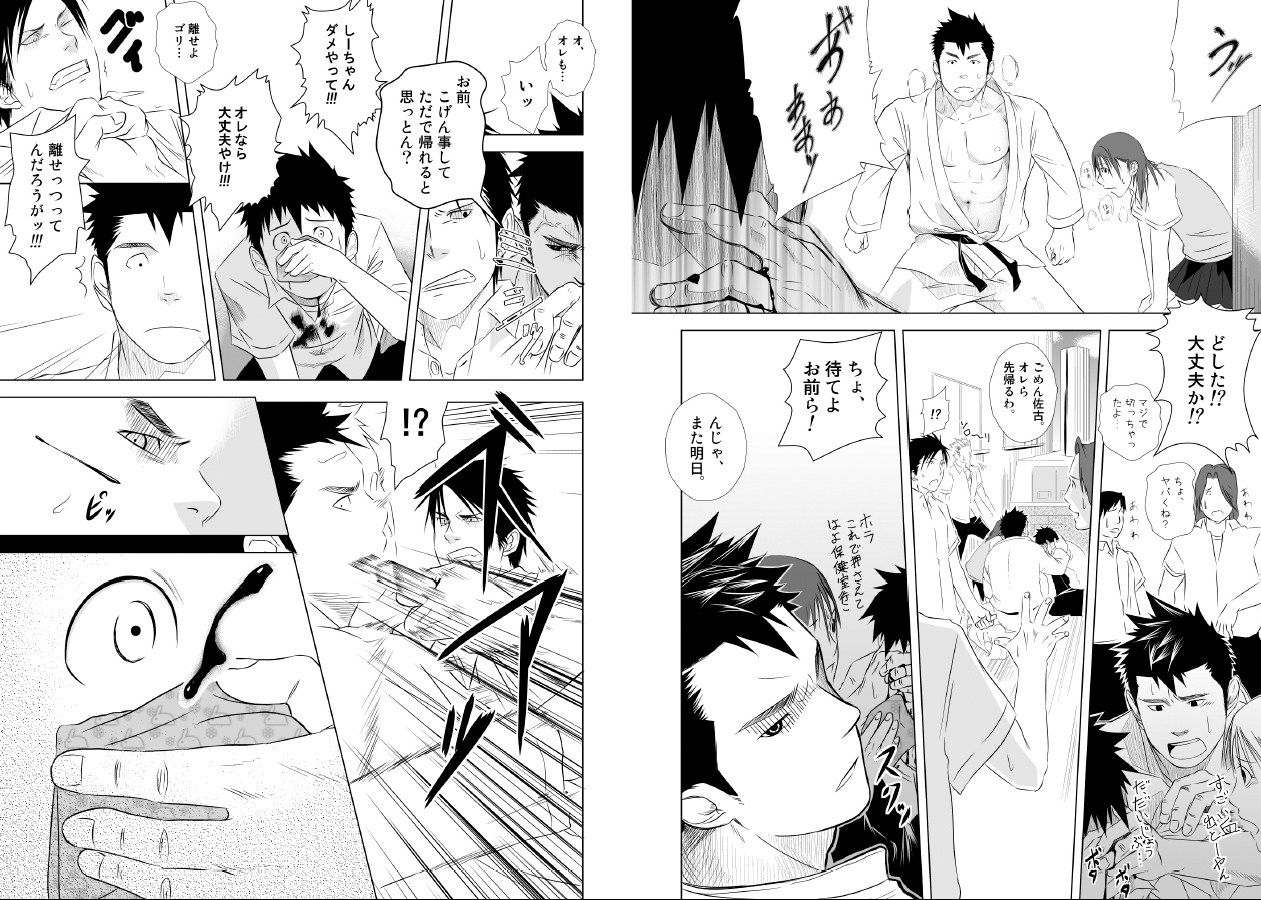 (ショタスクラッチ10) [♂めんたいこ♂ (一十)] いたいイタイいたい。1